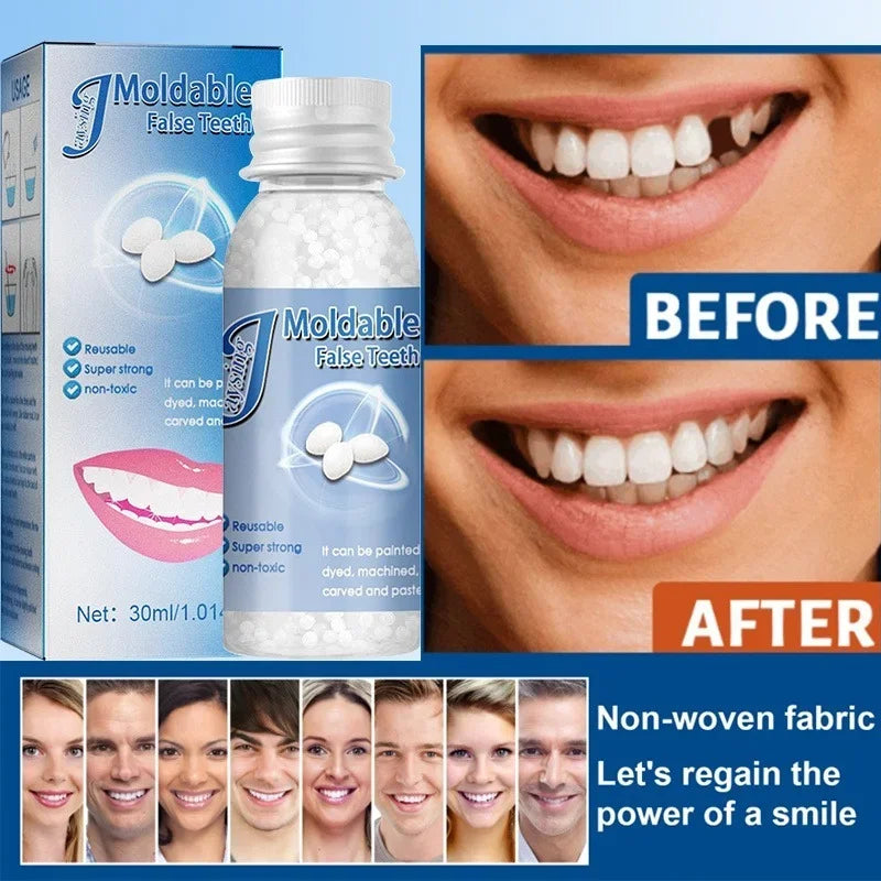 Moldable Teeth Repair Kit Temporary Dental Replacement Kit Moldable Thermal Beads For Filling The Missing And Broken Tooth Fake