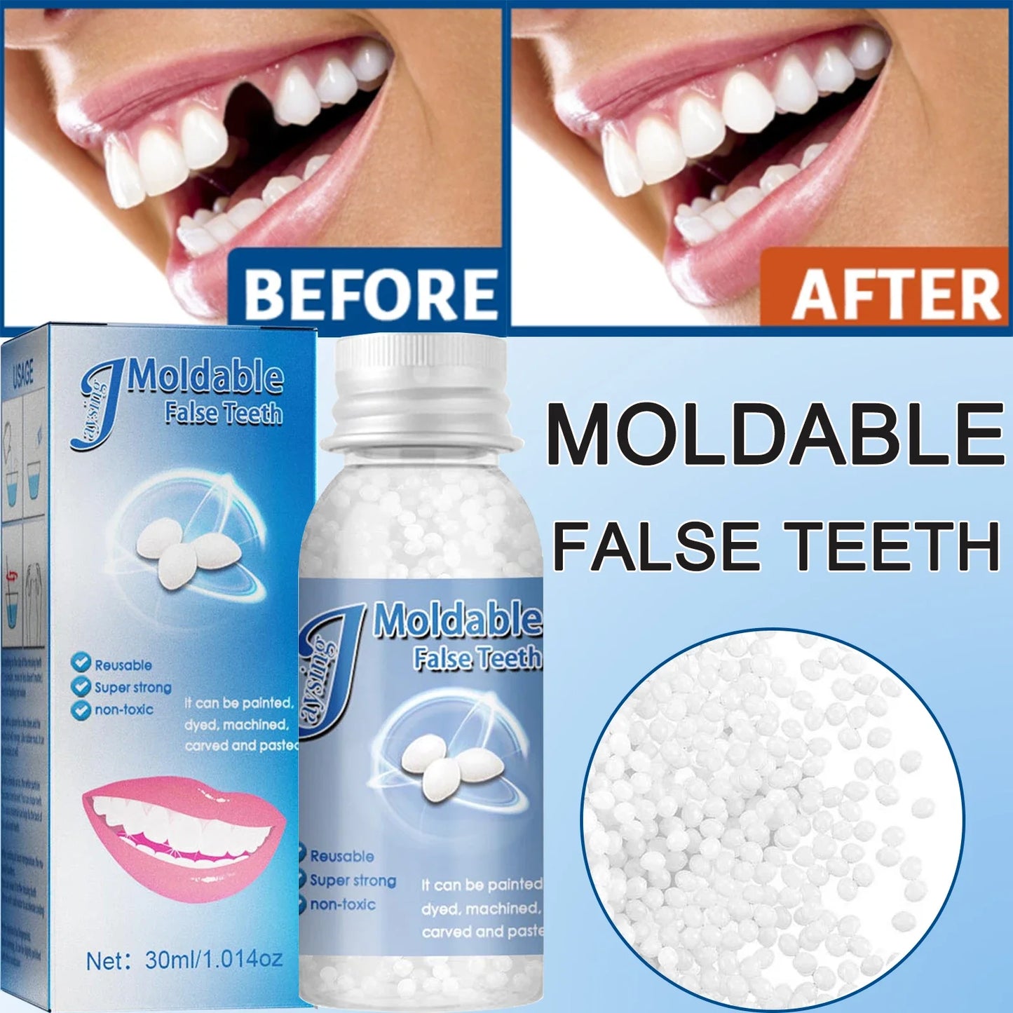 Moldable Teeth Repair Kit Temporary Dental Replacement Kit Moldable Thermal Beads For Filling The Missing And Broken Tooth Fake